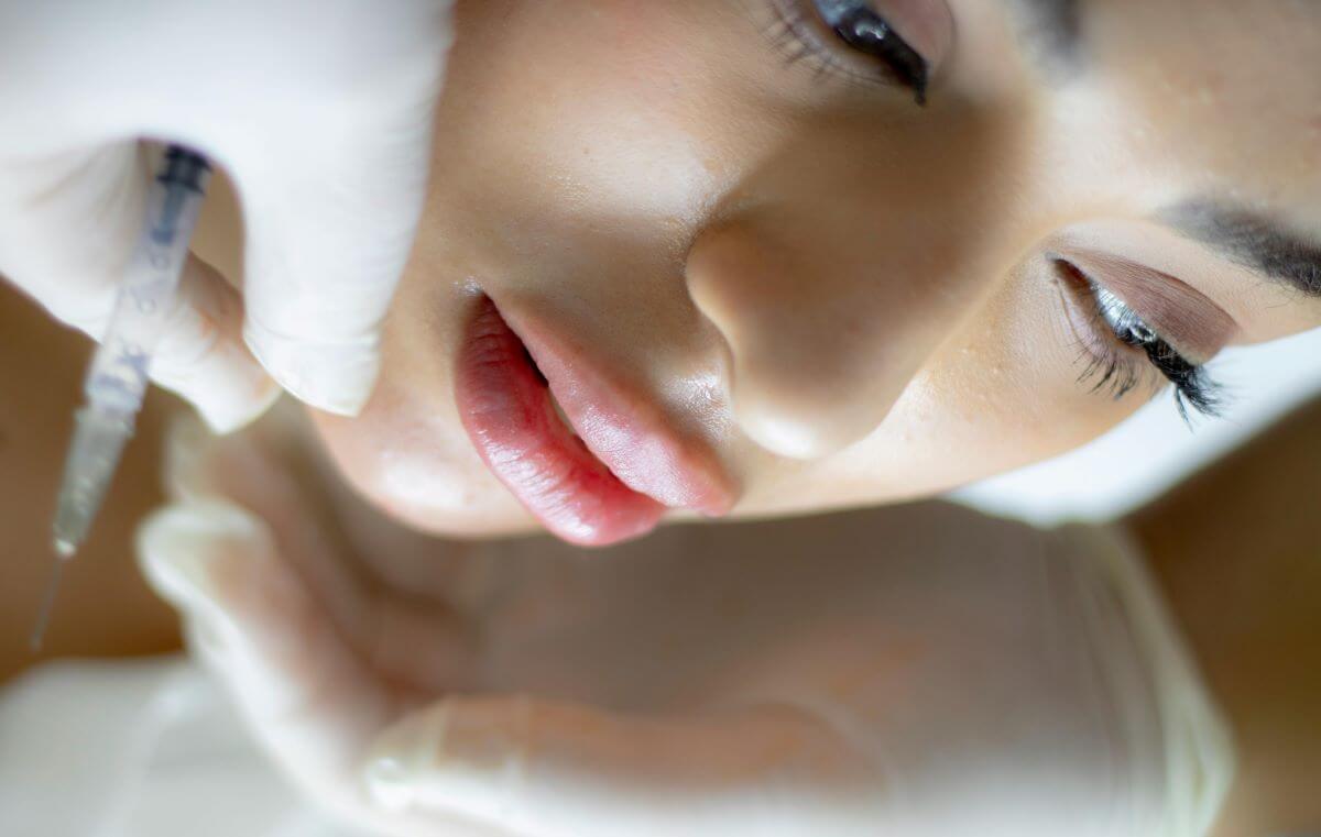 People Choose Lip Flip Over Fillers